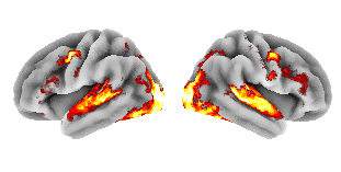 brain heatmap