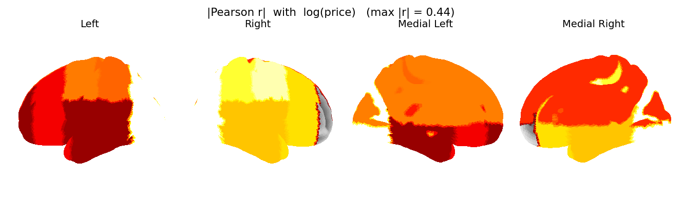 Brain regions colored by correlation strength